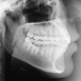 Radiologia Odontológica em Camaçari